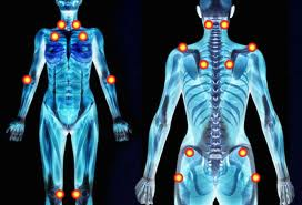 Fibromyalgia is characterized by chronic widespread pain in muscles, ligaments and tendons, numbness and tingling, palpitations, multiple tender points, tension, fatigue, migraine headaches and sleep disturbances. Fibromyalgia is characterized by chronic widespread pain in muscles, ligaments and tendons, numbness and tingling, palpitations, multiple tender points, tension, fatigue, migraine headaches and sleep disturbances.